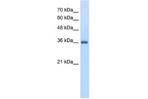 WB Suggested Anti-PPAP2A Antibody Titration:  5. (PPAP2A antibody  (N-Term))
