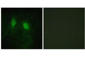 Immunofluorescence analysis of HeLa cells, using IKK- gamma (epitope around residue 85) antibody. (IKBKG antibody  (Ser85))