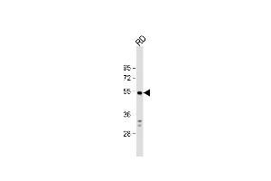 Anti-DUSP10 Antibody (N-term) at 1:1000 dilution + RD whole cell lysate Lysates/proteins at 20 μg per lane.