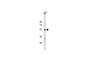 Anti-DUSP10 Antibody (N-term) at 1:1000 dilution + RD whole cell lysate Lysates/proteins at 20 μg per lane. (DUSP10 antibody  (N-Term))