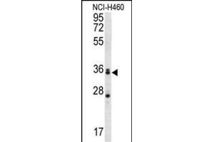 MBNL3 Antibody (Center) (ABIN657004 and ABIN2846185) western blot analysis in NCI- cell line lysates (35 μg/lane). (MBNL3 antibody  (AA 251-280))