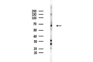 anti-CDK5 Regulatory Subunit Associated Protein 1 (CDK5RAP1) (C-Term) antibody