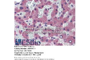 Immunohistochemistry (IHC) image for anti-Transferrin Receptor 2 (TFR2) (N-Term) antibody (ABIN2782221) (Transferrin Receptor 2 antibody  (N-Term))