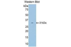 Western Blotting (WB) image for anti-Pyruvate Dehydrogenase beta (PDHB) (AA 65-336) antibody (ABIN1860164) (PDHB antibody  (AA 65-336))