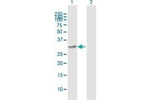 Western Blot analysis of CENPK expression in transfected 293T cell line by CENPK MaxPab polyclonal antibody. (CENPK antibody  (AA 1-269))