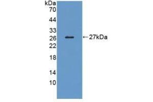 Detection of Recombinant LRP1B, Human using Polyclonal Antibody to Low Density Lipoprotein Receptor Related Protein 1B (LRP1B) (LRP1B antibody  (AA 31-194))