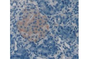 Used in DAB staining on fromalin fixed paraffin- embedded Kidney tissue (POMT1 antibody  (AA 318-513))