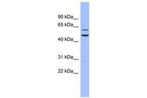 Image no. 1 for anti-Dyskeratosis Congenita 1, Dyskerin (DKC1) (AA 35-84) antibody (ABIN6742970) (DKC1 antibody  (AA 35-84))