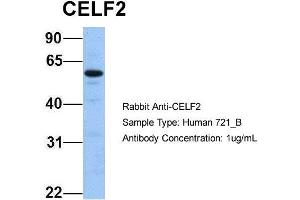 Host: Rabbit Target Name: CELF2 Sample Type: 721_B Antibody Dilution: 1. (CELF2 antibody  (N-Term))