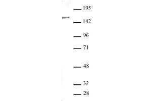SIN3A antibody (pAb) tested by Western blot. (SIN3A antibody  (N-Term))