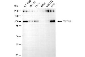 Western blotting analysis using ZNF598 antibody (ABIN7800899). (ZNF598 antibody)
