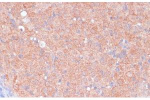 Immunohistochemistry of paraffin-embedded Rat ovary using LRP1 Polyclonal Antibody at dilution of 1:100 (40x lens). (LRP1 antibody)