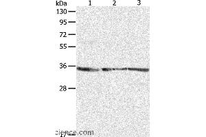 Western blot analysis of NIH/3T3, A431 and Jurkat cell, using RPLP0 Polyclonal Antibody at dilution of 1:750 (RPLP0 antibody)