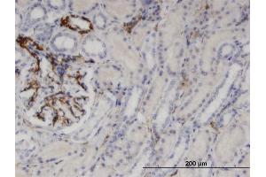 Immunoperoxidase of monoclonal antibody to UPP1 on formalin-fixed paraffin-embedded human kidney. (UPP1 antibody  (AA 1-92))