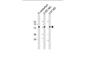 All lanes : Anti-SHC2 Antibody (N-Term) at 1:2000 dilution Lane 1: Human cerebellum lysate Lane 2: U-251 MG whole cell lysate Lane 3: U-87 MG whole cell lysate Lysates/proteins at 20 μg per lane. (SHC2 antibody  (AA 129-163))