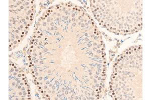 Immunohistochemistry (IHC) image for anti-Nuclear Factor of kappa Light Polypeptide Gene Enhancer in B-Cells Inhibitor, alpha (NFKBIA) (pSer32), (pSer36) antibody (ABIN6256292)
