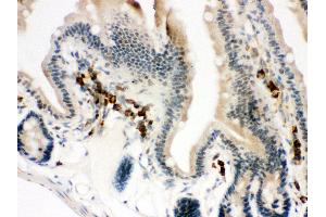 Anti- ACTIN antibody, IHC(P) IHC(P): Mouse Intestine Tissue (Actin antibody  (C-Term))