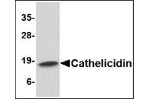 Western blot analysis of Cathelicidin in Human spleen tissue lysate with Cathelicidin antibody at 1 µg/ml. (Cathelicidin antibody  (C-Term))