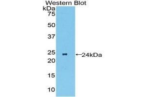 Detection of Recombinant MST1R, Mouse using Polyclonal Antibody to Macrophage Stimulating 1 Receptor (MST1R) (MST1R antibody  (AA 89-275))