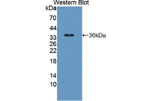 Detection of Recombinant TAK1L, Human using Polyclonal Antibody to TAK1 Like Protein (TAK1L) (MAP3K7CL antibody  (AA 1-242))