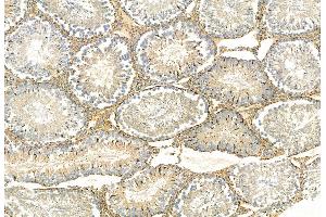 ABIN6261678 and ABIN6268891 at 1/100 staining Rat testis tissue by IHC-P. (FAP antibody  (Internal Region))