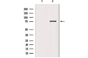 Western blot analysis of extracts from mouse brain, using HKR1 Antibody. (HKR1 antibody)