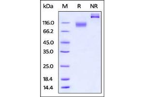 Mouse IL-23 R, Fc Tag on SDS-PAGE under reducing (R) and no-reducing (NR) conditions. (IL23R Protein (AA 24-372) (Fc Tag))