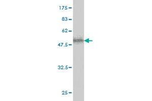 Western Blot detection against Immunogen (58. (ICK antibody  (AA 1-292))