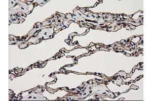 Image no. 3 for anti-Annexin A3 (ANXA3) antibody (ABIN1496642) (Annexin A3 antibody)