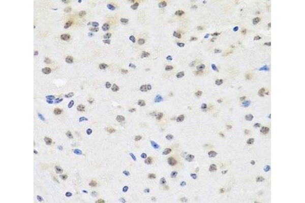 SAFB2 antibody