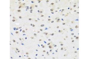 Immunohistochemistry of paraffin-embedded Mouse brain using SAFB2 Polyclonal Antibody at dilution of 1:100 (40x lens). (SAFB2 antibody)