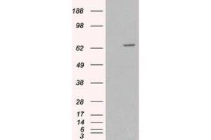 Western Blotting (WB) image for anti-Myotubularin 1 (MTM1) (C-Term) antibody (ABIN2465965) (MTM1 antibody  (C-Term))
