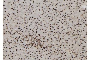 ABIN6272965 at 1/100 staining Mouse liver tissue by IHC-P.