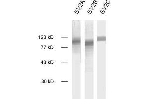 SV2B antibody  (AA 2-17)