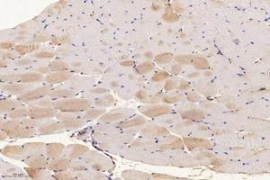 Immunohistochemistry analysis of paraffin-embedded mouse muscle using,SLC8A3 (ABIN7075684) at dilution of 1: 1600