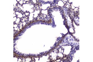 IHC analysis of MYLK using anti-MYLK antibody .