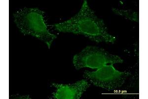 Immunofluorescence of monoclonal antibody to ALDH9A1 on HeLa cell. (ALDH9A1 antibody  (AA 173-270))