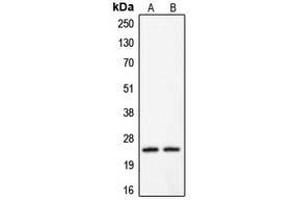 Western blot analysis of Claudin 2 expression in HeLa (A) (Claudin 2 antibody  (C-Term))