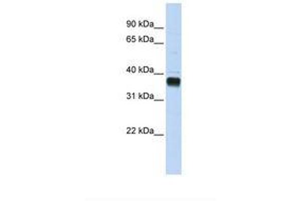 NUDT18 Antikörper  (AA 252-301)