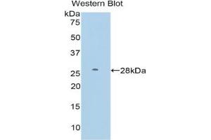Western blot analysis of the recombinant protein. (FDFT1 antibody  (AA 187-416))