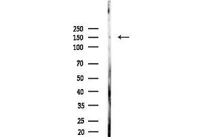 anti-Ubiquitin Specific Peptidase 42 (USP42) (Internal Region) antibody