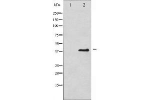 Western Blotting (WB) image for anti-Eukaryotic Translation Initiation Factor 2 Subunit 1 (EIF2S1) (pSer51) antibody (ABIN6255389)
