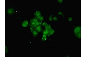 Immunofluorescent analysis of MCF-7 cells using ABIN7161840 at dilution of 1:100 and Alexa Fluor 488-congugated AffiniPure Goat Anti-Rabbit IgG(H+L) (NUP214 antibody  (AA 28-238))