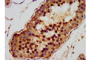 IHC image of ABIN7144009 diluted at 1:200 and staining in paraffin-embedded human testis tissue performed on a Leica BondTM system.