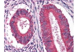 Immunohistochemical analysis of paraffin-embedded human Uterus tissues using anFtEG antibody (EGF antibody)