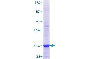 Adiponectin Receptor 1 Protein (ADIPOR1) (AA 72-136) (GST tag)