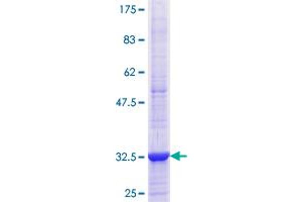 Adiponectin Receptor 1 Protein (ADIPOR1) (AA 72-136) (GST tag)