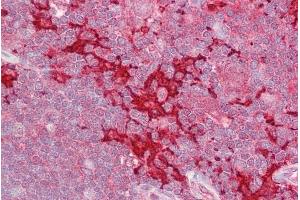 ABIN184758 (2. (MAP4K1 antibody  (N-Term))