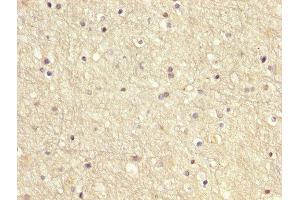 IHC image of ABIN7166949 diluted at 1:200 and staining in paraffin-embedded human brain tissue performed on a Leica BondTM system. (GDI1 antibody  (AA 35-170))