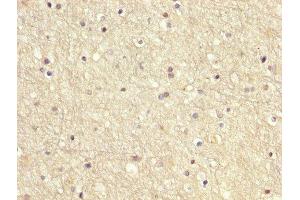 IHC image of ABIN7166949 diluted at 1:200 and staining in paraffin-embedded human brain tissue performed on a Leica BondTM system. (GDI1 antibody  (AA 35-170))
